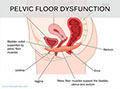 pelvic-floor